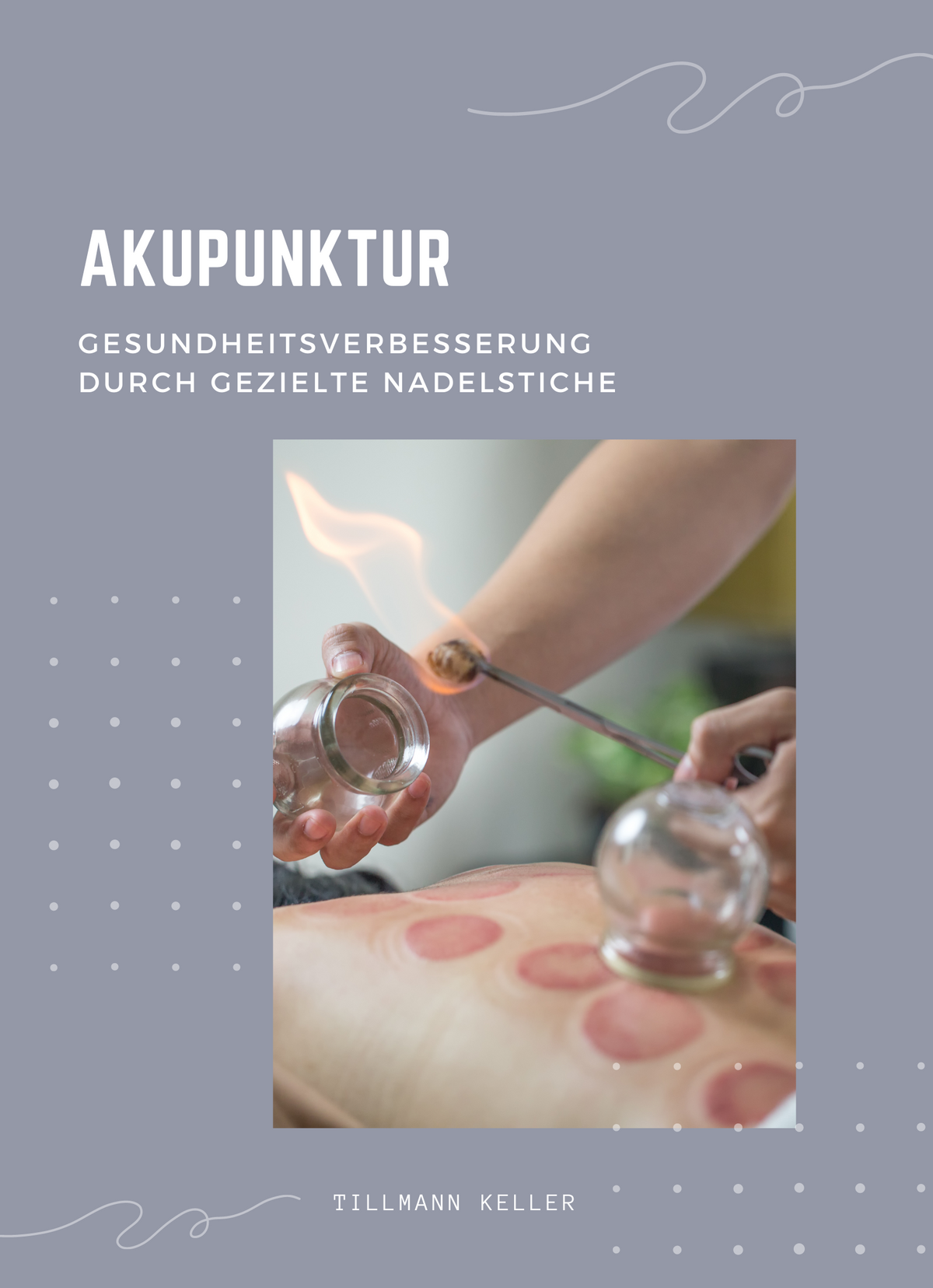 Akupunktur