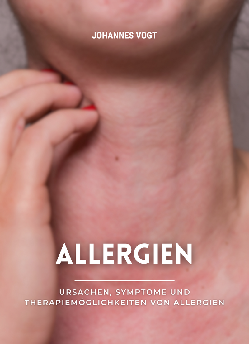 Allergien